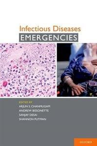 Infectious Diseases Emergencies - Click Image to Close