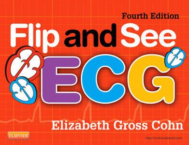 Flip and See ECG - Click Image to Close