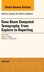 Cone Beam Computed Tomography: From Capt