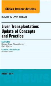 Liver Transplantation: Update of Concept