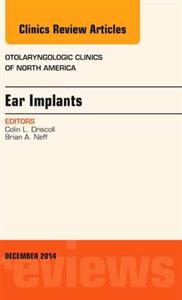 Ear Implants, An Issue of Otolaryngologi