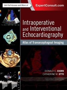 Atlas Intraoperative Transesophageal 2E
