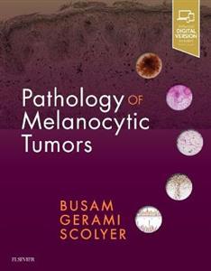 Pathology of Melanocytic Tumors - Click Image to Close