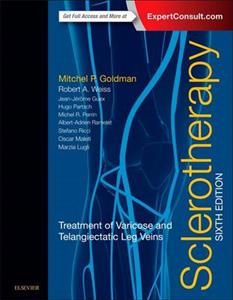 Sclerotherapy: Treatment of Varicose and Telangiectatic Leg Veins 6th edition - Click Image to Close