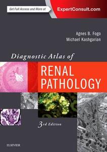 Diagnostic Atlas of Renal Pathology 3rd edition - Click Image to Close