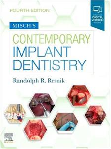 Contemporary Implant Dentistry 4e