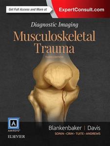 Diagnostic Imaging: Musculoskeletal Trauma - Click Image to Close