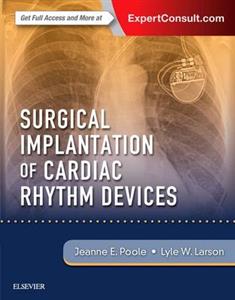 Surgical Implantation of Cardiac Rhythm Devices - Click Image to Close