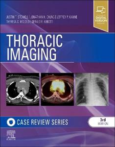 Thoracic Imaging: Case Review - Click Image to Close