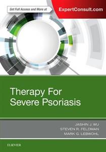 Therapy for Severe Psoriasis - Click Image to Close