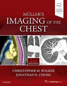 Muller's Imaging of the Chest 2e - Click Image to Close