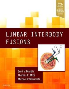 Lumbar Interbody Fusions - Click Image to Close