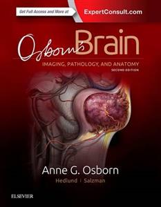 Osborn's Brain: Imaging, Pathology, and Anatomy, 2nd Edition - Click Image to Close