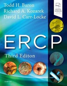 ERCP - Click Image to Close