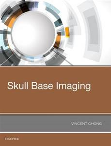 Skull Base Imaging - Click Image to Close