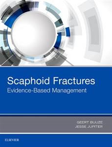 Scaphoid Fractures: Evidence-Based Mgmt - Click Image to Close