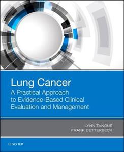 Lung Cancer: A Practical Approach to Evidence-Based Clinical Evaluation and Management - Click Image to Close