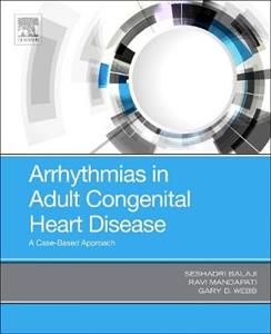 Arrhythmias in Adult Congenital Heart