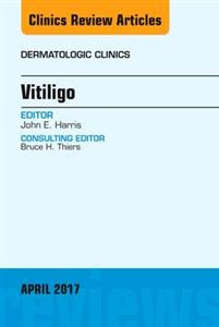 Vitiligo V35-2 - Click Image to Close