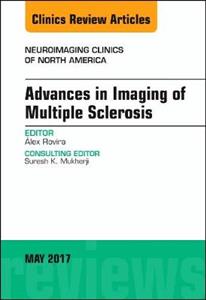 Imaging of Multiple Sclerosis - Click Image to Close