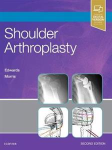 Shoulder Arthroplasty - Click Image to Close