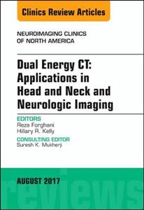 Dual Energy CT: Apps in Head, Neck and - Click Image to Close