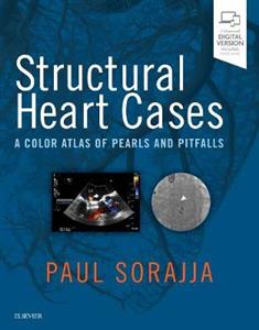 Structural Heart Cases: A Color Atlas of Pearls and Pitfalls - Click Image to Close
