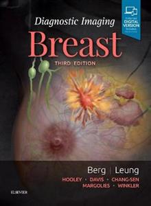 Diagnostic Imaging: Breast - Click Image to Close