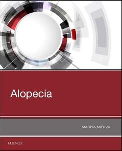 Alopecia - Click Image to Close