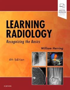 Learning Radiology: Recognizing the Basics Learning Radiology: Recognizing the Basics