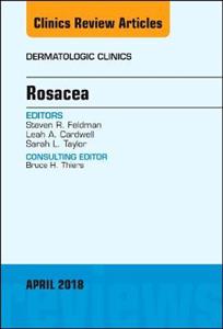 Rosacea, An Issue of Dermatologic Clinics - Click Image to Close