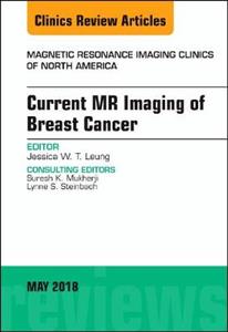 Current MR Imaging of Breast Cancer, An Issue of Magnetic Resonance Imaging Clinics of North America - Click Image to Close