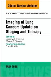 Lung Cancer, An Issue of Radiologic Clinics of North America - Click Image to Close