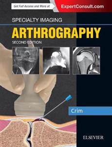 Specialty Imaging: Arthrography - Click Image to Close