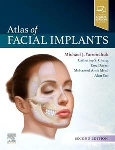 Atlas of Facial Implants 2E - Click Image to Close