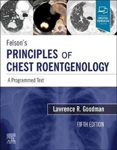 Felson's Principles Chest Roentgenolo 5E - Click Image to Close