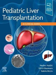 Pediatric Liver Transplantation - Click Image to Close