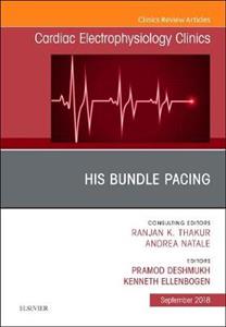 His Bundle Pacing, An Issue of Cardiac - Click Image to Close