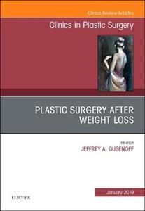 Plastic Surgery After Weight Loss - Click Image to Close