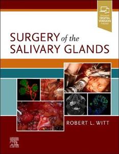 Surgery of the Salivary Glands - Click Image to Close