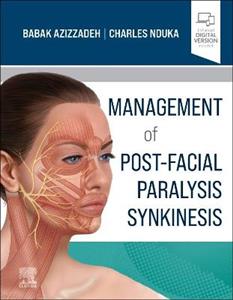 Video Atlas of Facial Paralysis - Click Image to Close