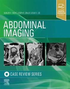 Abdominal Imaging: Case Review Series - Click Image to Close