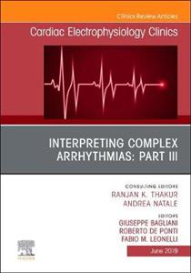 Interpreting Complex Arrhythmias: - Click Image to Close