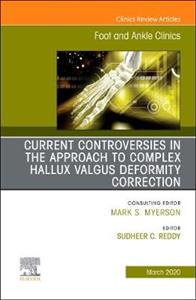 Contro Approach Complex Hallux Valgus