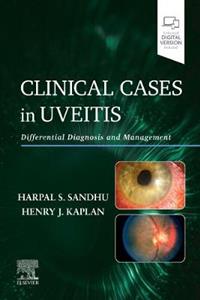 Clinical Cases in Uveitis - Click Image to Close