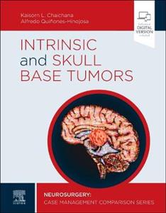 Intrinsic and Skull Base Tumors - Click Image to Close