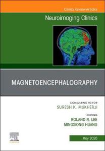 Magnetoencephalography - Click Image to Close