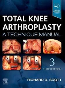 Total Knee Arthroplasty 3E - Click Image to Close