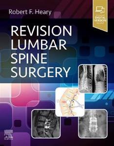 Revision Lumbar Spine Surgery - Click Image to Close