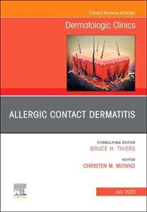 Allergic Contact Dermatitis - Click Image to Close